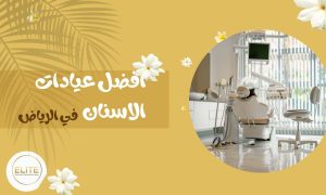 افضل عيادات الاسنان في الرياض