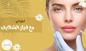 تجربتي مع فيلر الشفايف: النتائج، المميزات، والنصائح قبل وبعد حقن الفيلر بالرياض