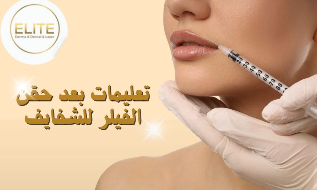 تعليمات بعد حقن الفيلر للشفايف