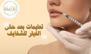 تعليمات بعد حقن الفيلر للشفايف