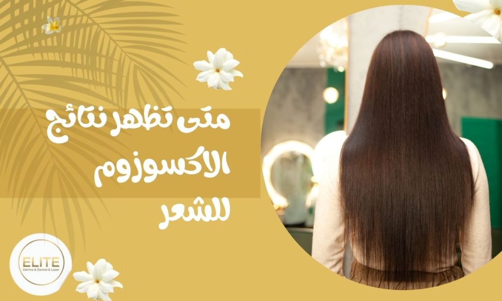 متى تظهر نتائج الاكسوزوم للشعر
