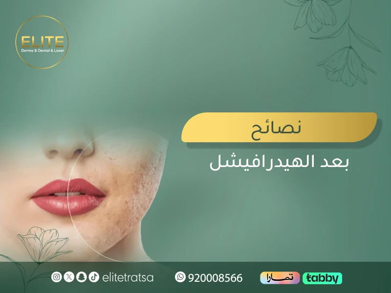نصائح بعد الهيدرافيشل