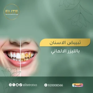 تبييض الاسنان بالليزر الالماني