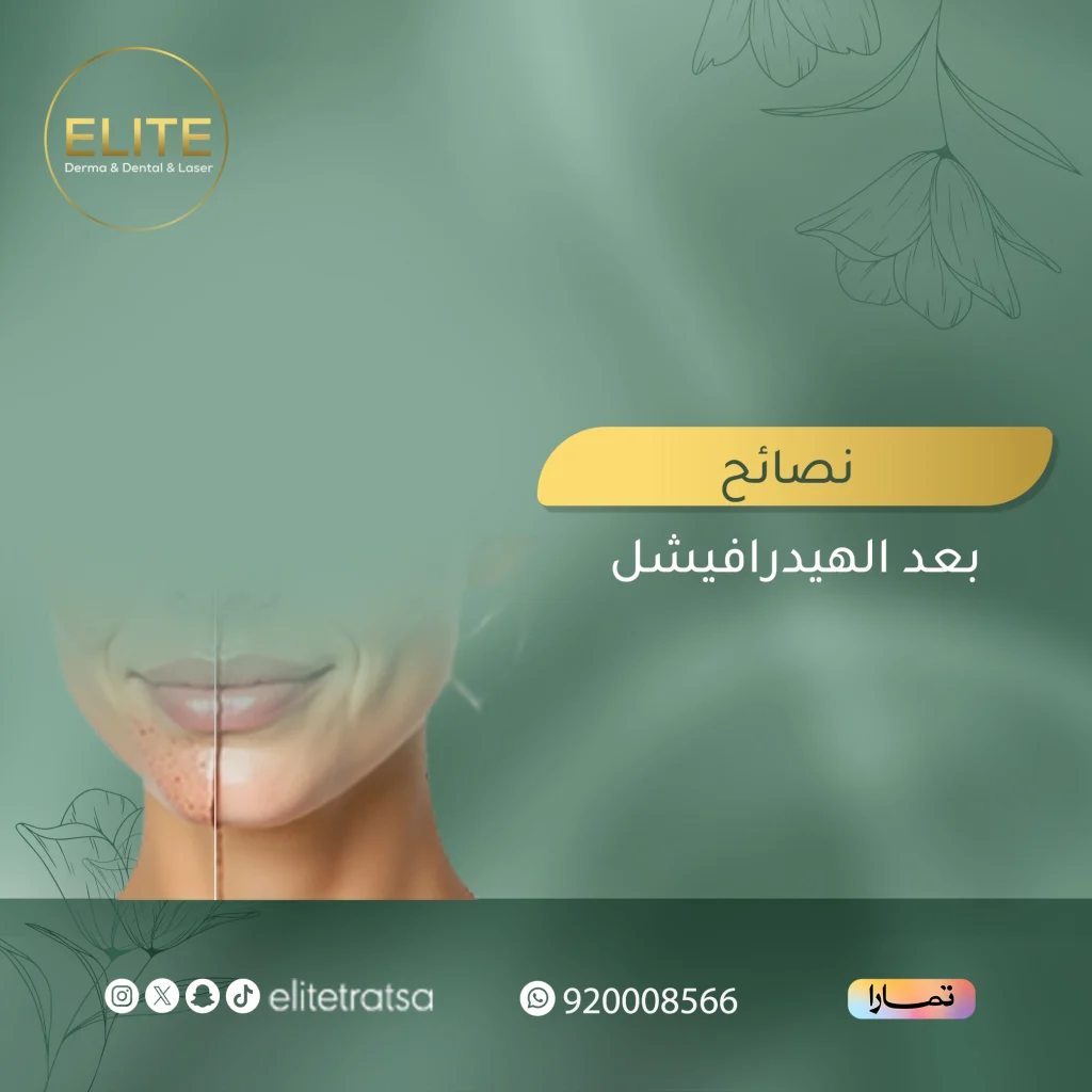 نصائح بعد الهيدرافيشل