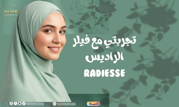 متى تظهر نتائج فيلر الراديس؟