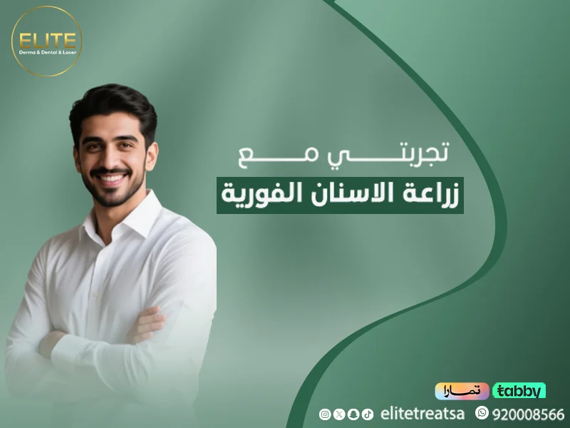 تجربتي مع زراعة الأسنان الفورية – وهل زراعة الأسنان الفورية ناجحة⁉️