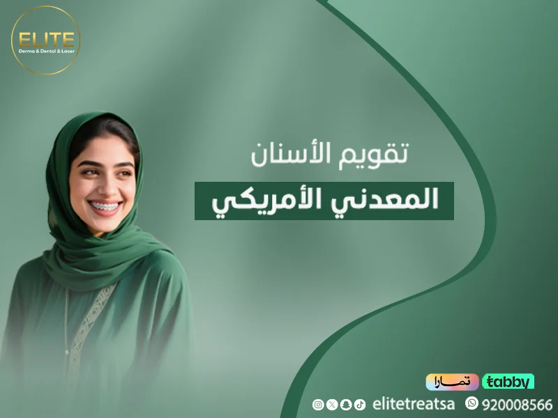 تقويم الأسنان المعدني الأمريكي