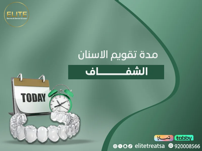 مدة تقويم الأسنان الشفاف في الرياض: تجربتي مع التقويم الشفاف
