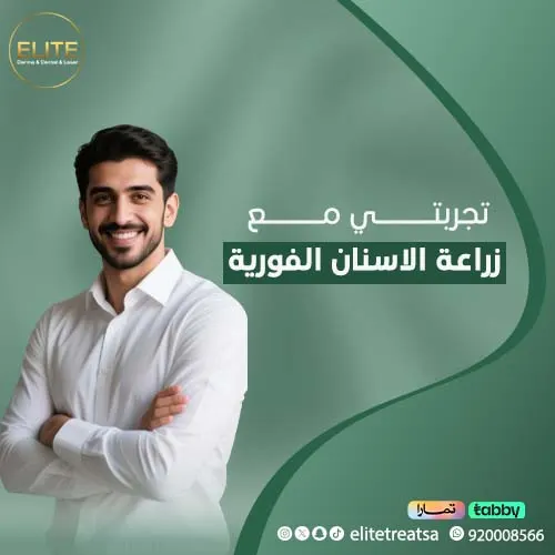 تجربتي مع زراعة الأسنان الفورية – وهل زراعة الأسنان الفورية ناجحة⁉️