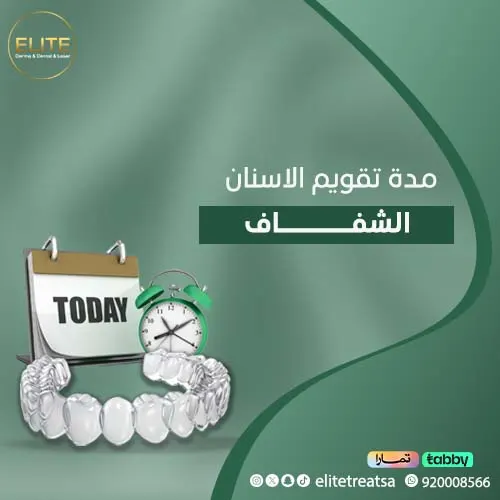 تجربتي مع التقويم الشفاف