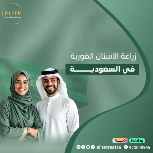 زراعة الاسنان الفورية في السعودية