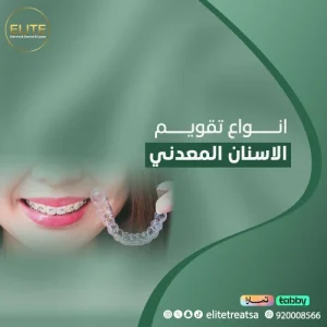 أنواع تقويم الأسنان المعدني في الرياض – افضل عروض واسعار بريسز الأسنان باليرموك