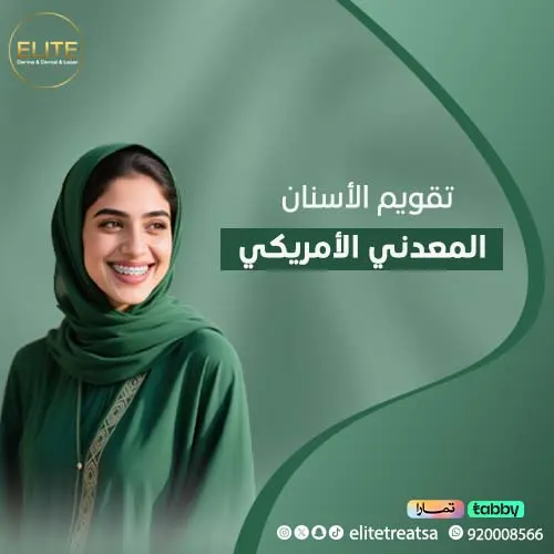 تقويم الأسنان المعدني الأمريكي