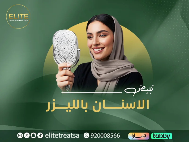 تجربتي مع تبييض الأسنان بالليزر