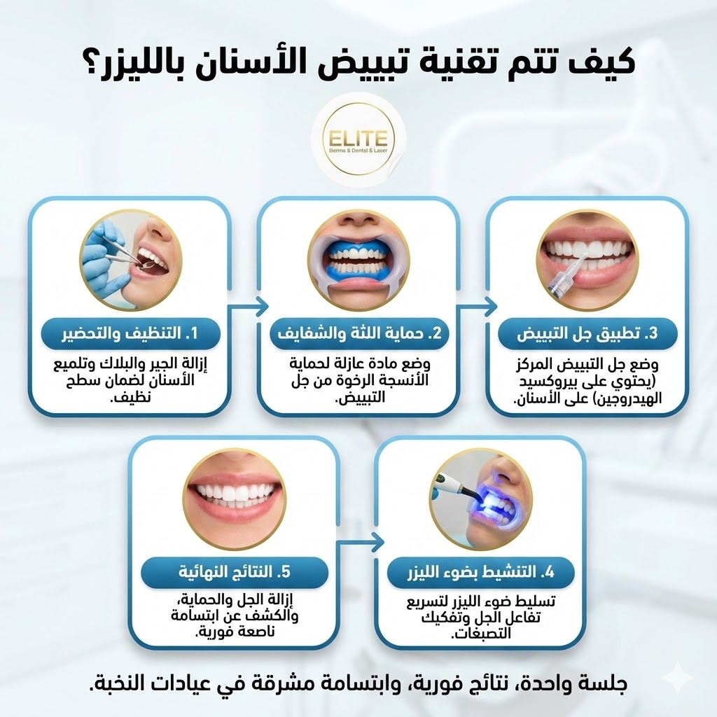 كيف تتم تقنية التبييض بالليزر؟