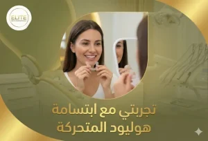 تجربتي مع ابتسامة هوليود المتحركة: كم جلسة تحتاج ابتسامة هوليود؟