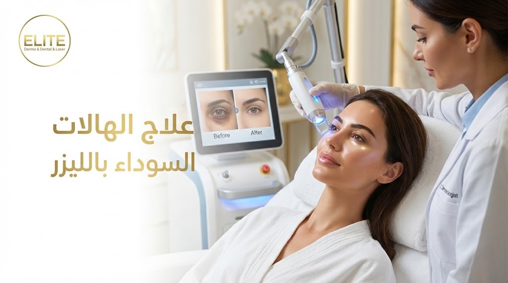 علاج الهالات السوداء بالليزر
