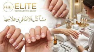 مشاكل الأظافر