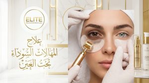 علاج الهالات السوداء تحت العين بأحدث التقنيات