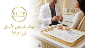قوالب تبييض الاسنان في العيادة