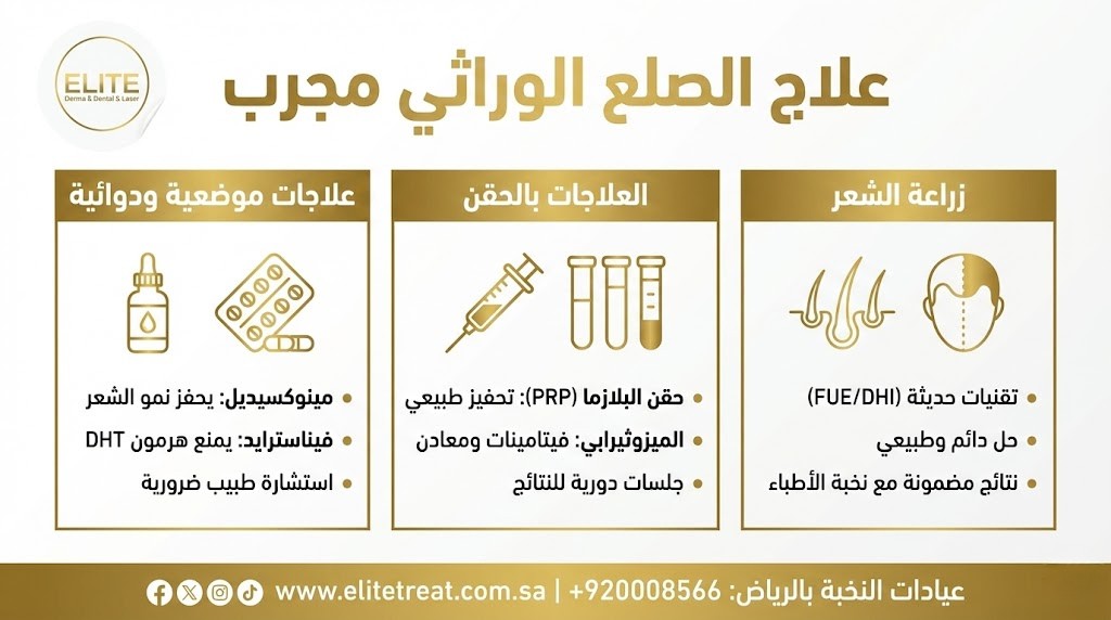 علاج الصلع الوراثي مجرب