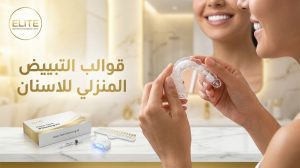 قوالب التبييض المنزلي للأسنان