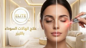 علاج الهالات السوداء بالليزر