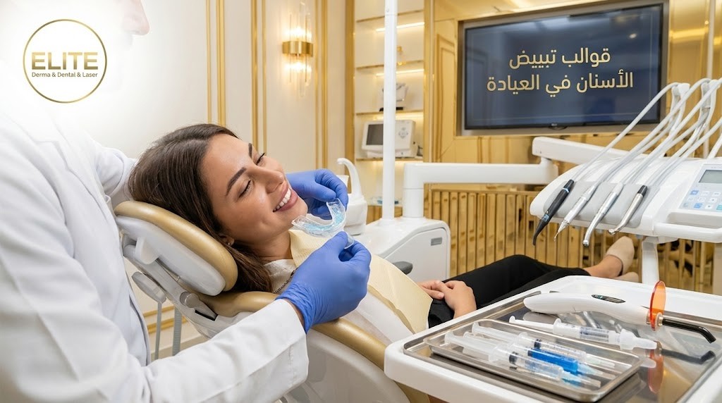 قوالب تبييض الاسنان في العيادة