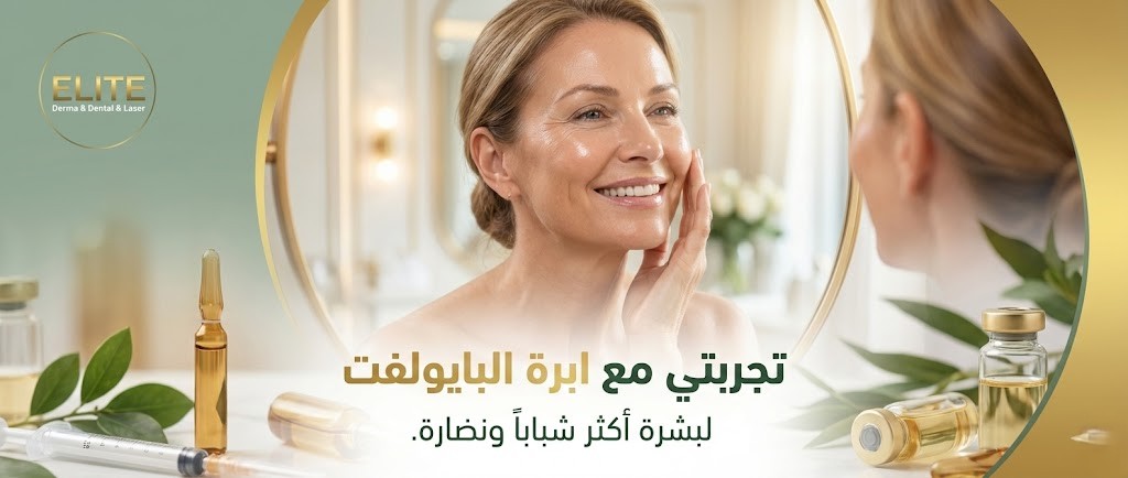 تجربتي مع إبرة البايولفت للوجه: متى تبان نتيجة إبرة البايولفت؟