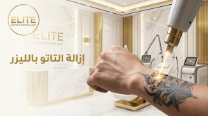 ازالة التاتو بالليزر: رحلة العودة إلى بشرة صافية