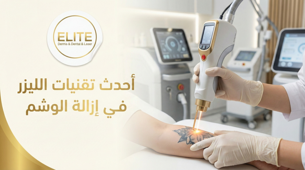 أحدث تقنيات الليزر في إزالة الوشم