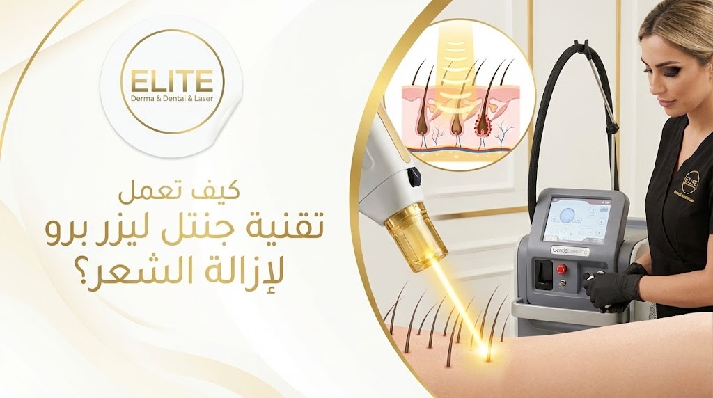 كيف تعمل تقنية جنتل ليزر برو لإزالة الشعر؟