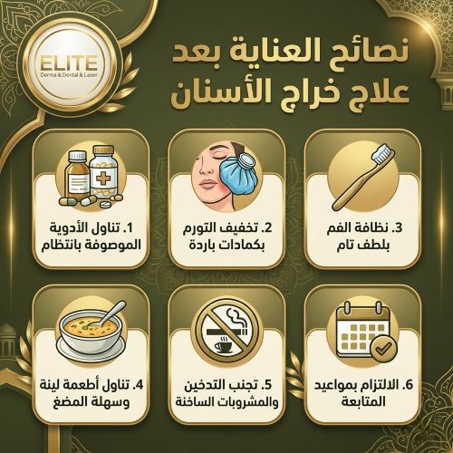 تجربتي مع مركز النخبة في علاج خراج الأسنان: نصائح لعلاج خراج الاسنان