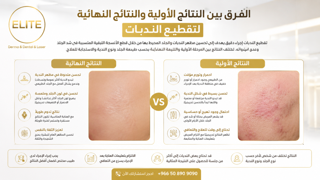 الفرق بين النتائج الأولية والنتائج النهائية لتقطيع الندبات