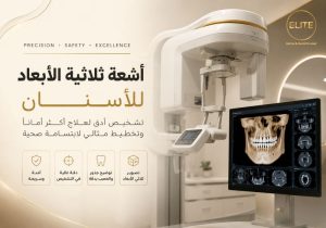 أشعة ثلاثية الأبعاد للأسنان (CBCT): للتشخيص الدقيق وتخطيط العلاج في طب الأسنان الحديث
