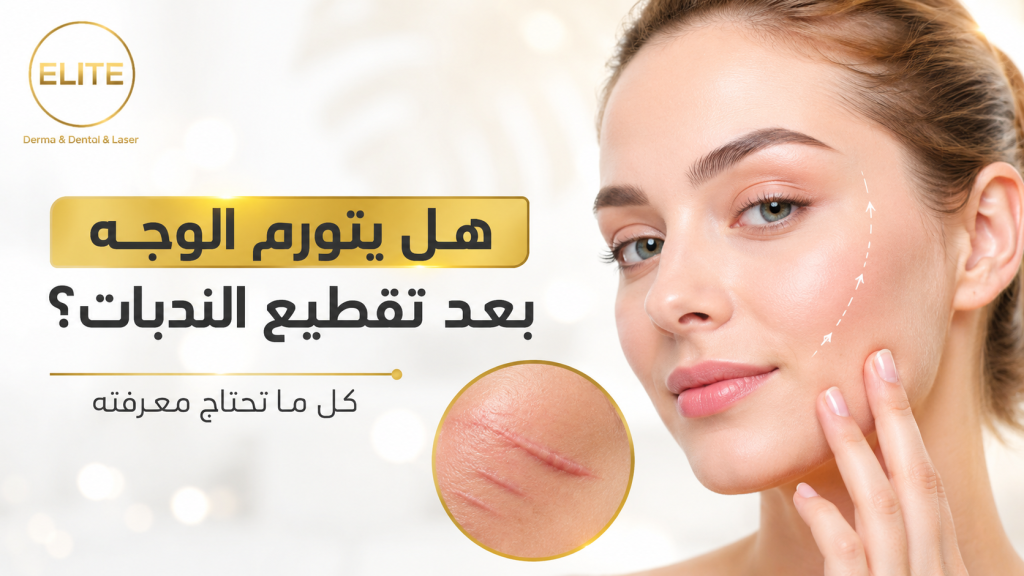 هل يتورم الوجه بعد تقطيع الندبات؟