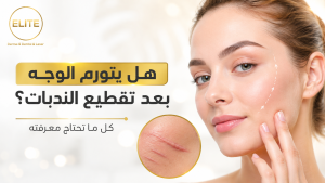 هل يتورم الوجه بعد تقطيع الندبات؟