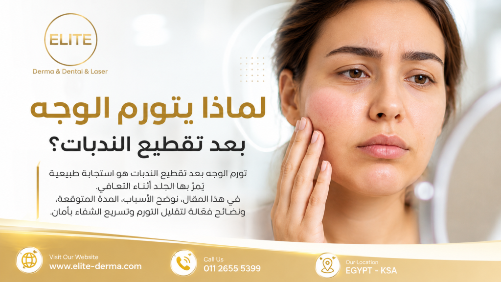 لماذا يتورم الوجه تحديداً بعد تقطيع الندبات