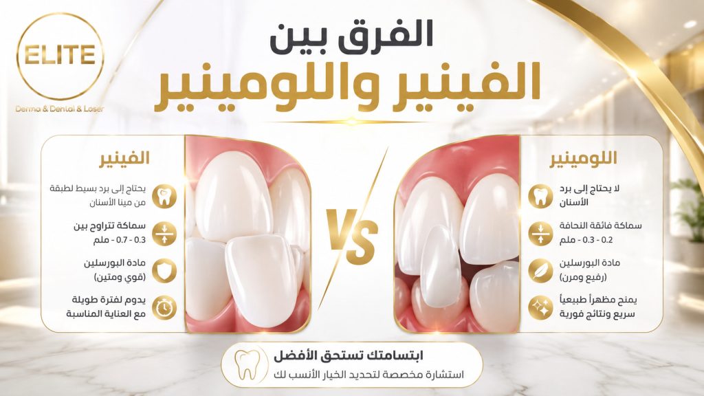 الفرق بين الفينير واللومينير