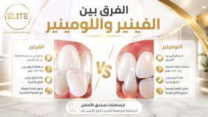 الفرق بين الفينير واللومينير