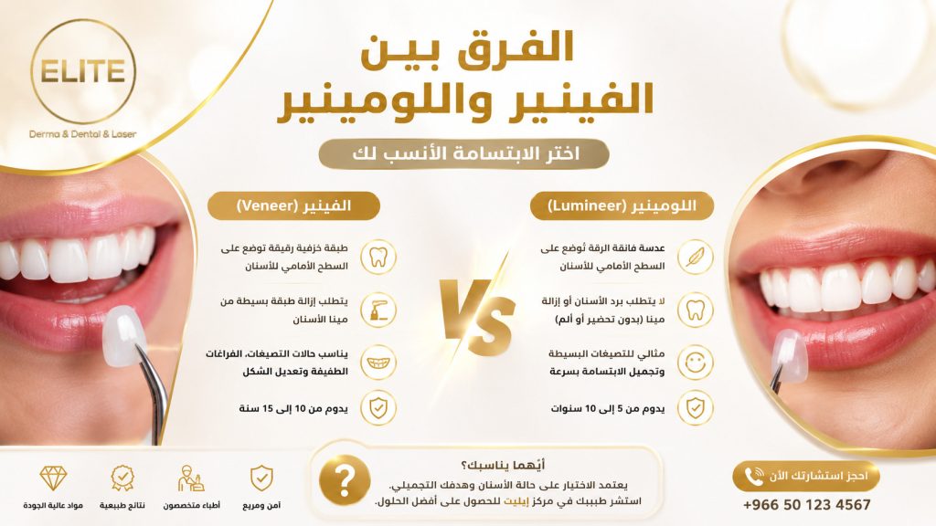 الفرق بين الفينير واللومينير
