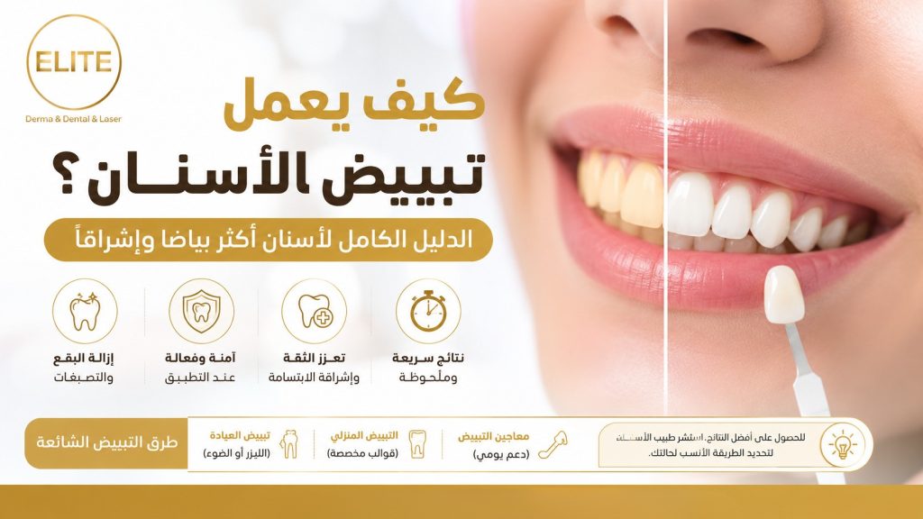 كيف يعمل تبييض الأسنان؟