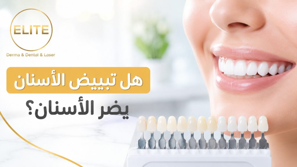 هل تبييض الأسنان يضر الأسنان؟