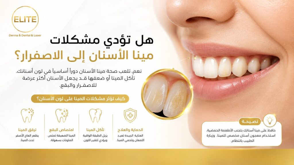 هل تؤدي مشكلات مينا الأسنان إلى الاصفرار؟