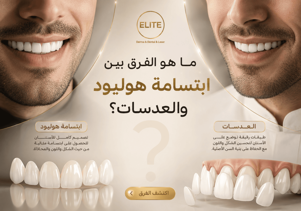 ما هو الفرق بين ابتسامة هوليود والعدسات؟ اختر الابتسامة المناسبة لك