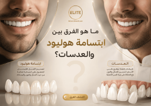 ما هو الفرق بين ابتسامة هوليود والعدسات؟ اختر الابتسامة المناسبة لك