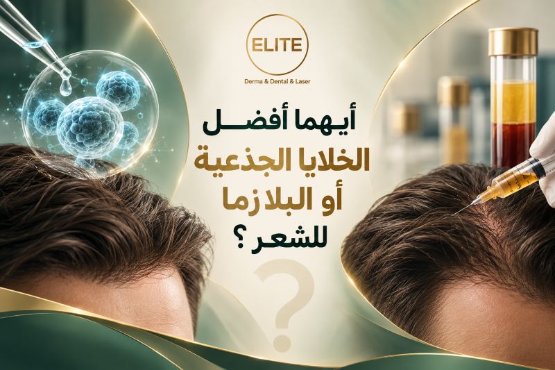 أيهما أفضل الخلايا الجذعية أو البلازما للشعر