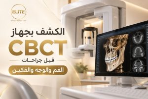 الكشف بجهاز CBCT قبل جراحات الفم والوجه والفكين