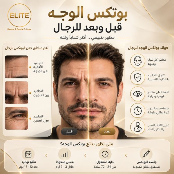 بوتكس الوجه قبل وبعد للرجال_