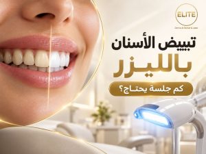 تبييض الأسنان بالليزر كم جلسة يحتاج